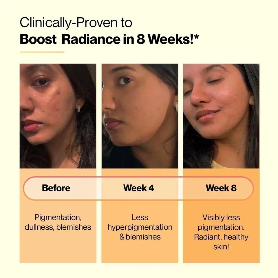 Setu Skin Renew Glutathione Effervescent Tablets Pack of 4