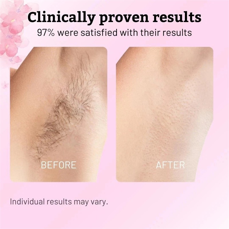 NEW Cyperus Rotundus Oil – 60ml Natural Cyperus Rotundus Oil For Hair Removal