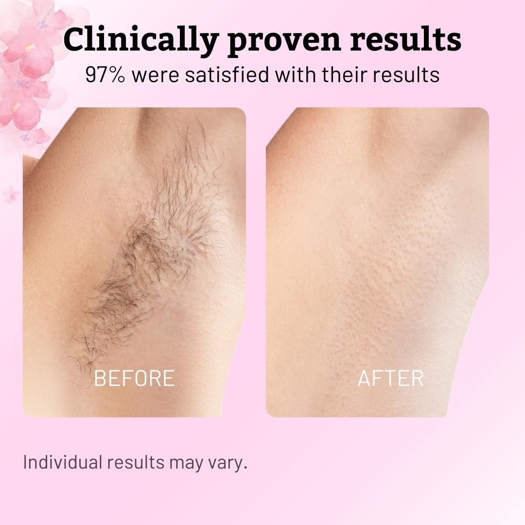 Cyperus Rotundus Oil – 60ml Natural Cyperus Rotundus Oil For Hair Removal, Mo.-+