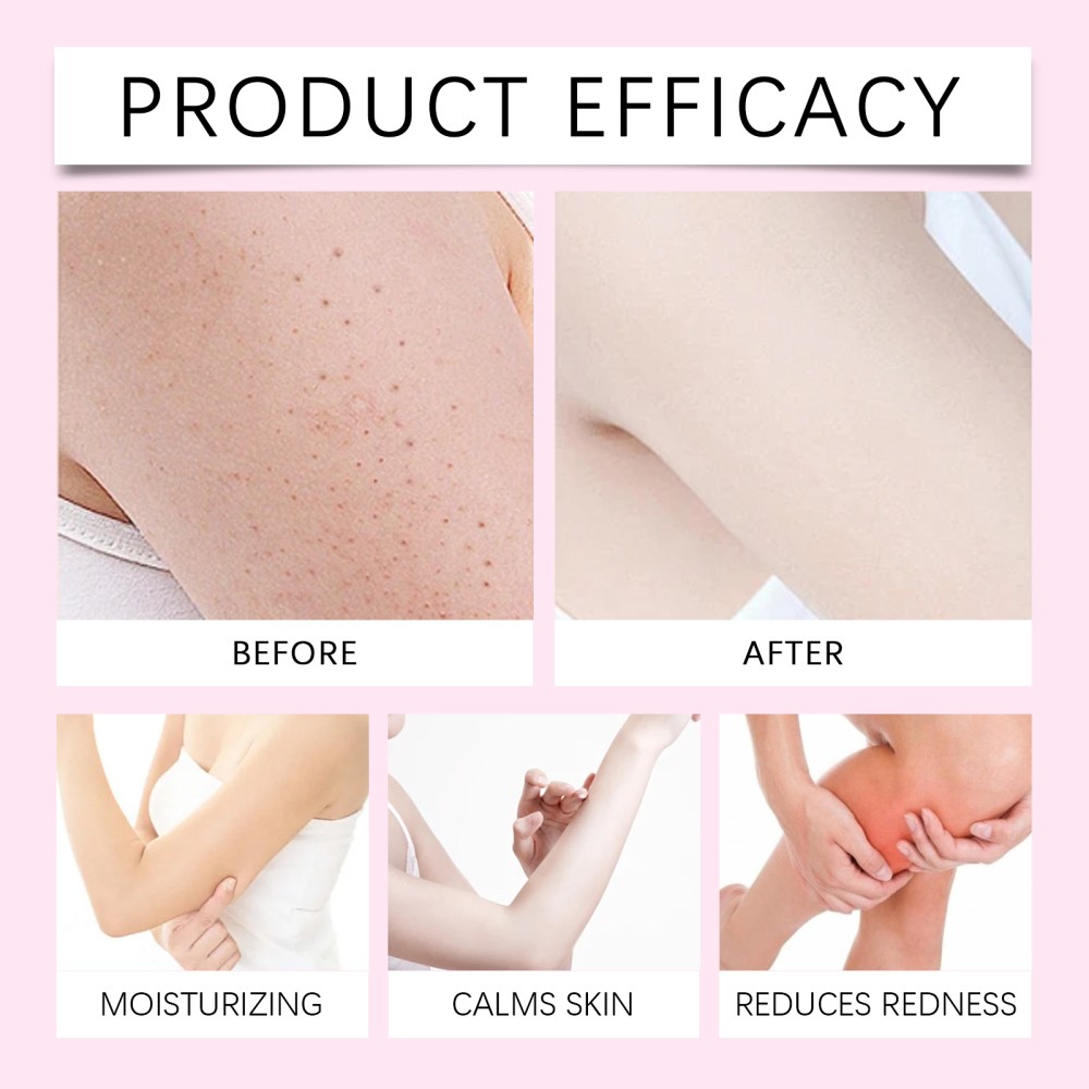 – Rotundus Oil Slows Unwanted Body Hair Growth Cyperus Post Waxing/Shaving Care
